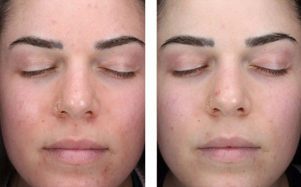 AlphaRet Clearing Serum