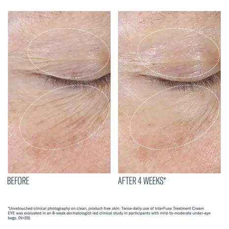 InterFuse Treatment Cream EYE